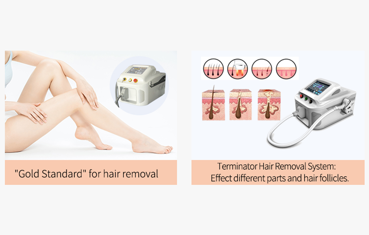 The most genuine and reliable hair removal machine