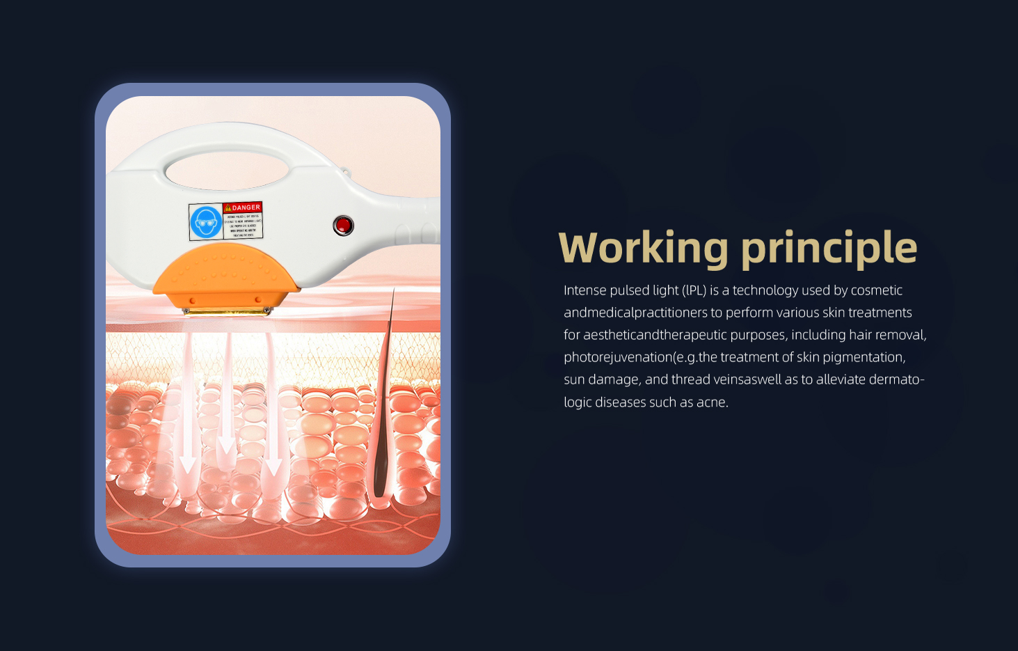 Working Principle