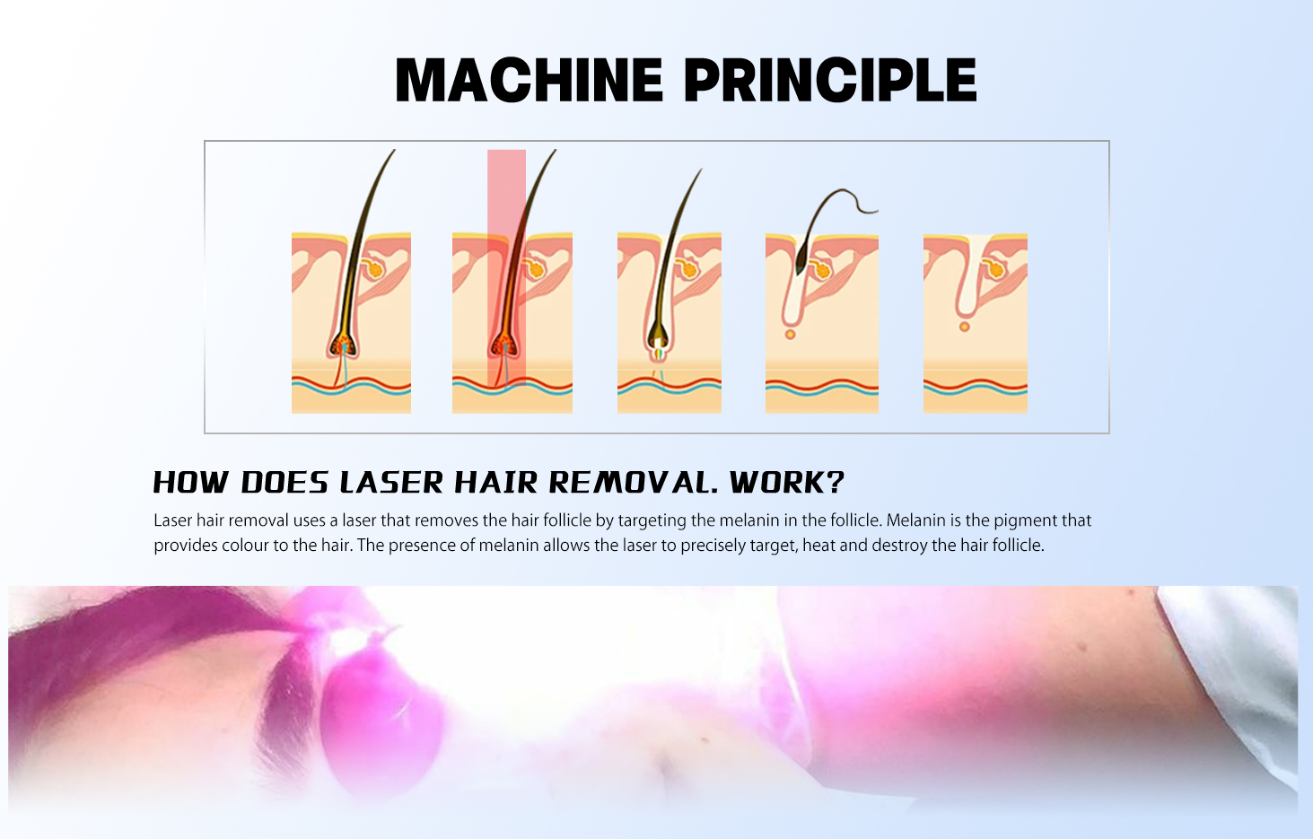 The treatment handle band is optional, and the application range is wider
