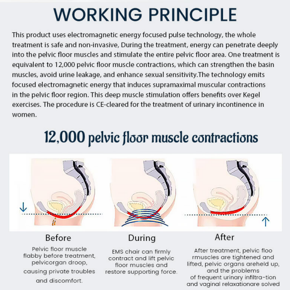 WORKING PRINCIPLE